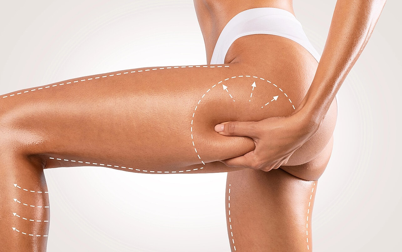 The Truth About Fat Transfer: Is It a Good Fit for You?