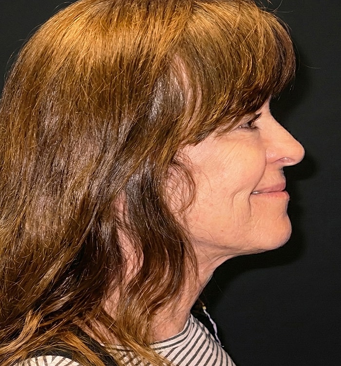 Profile of a smiling woman with brown hair.