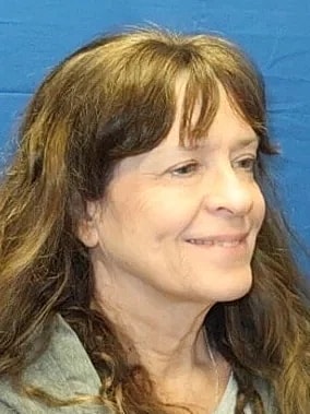 Facelift Before & After