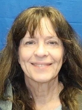 Facelift Before & After